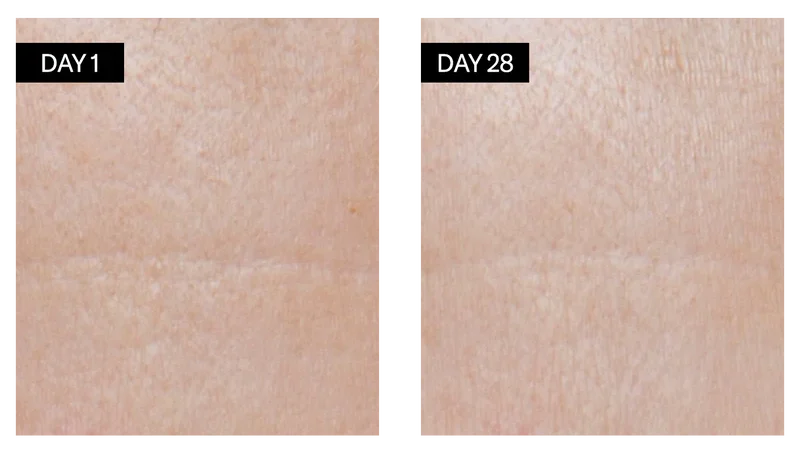 Two mages showing visible results of Odacité Retinol + Hyaluronic acid Serum in a period of 28 days